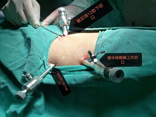 亚洲精品巨爆乳无码大乳巨