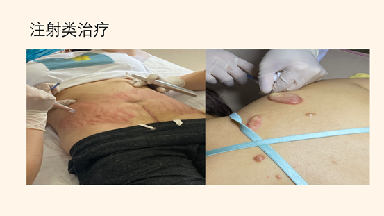 亚洲精品巨爆乳无码大乳巨