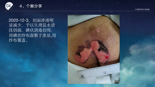 亚洲精品巨爆乳无码大乳巨