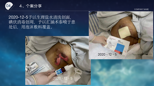 亚洲精品巨爆乳无码大乳巨