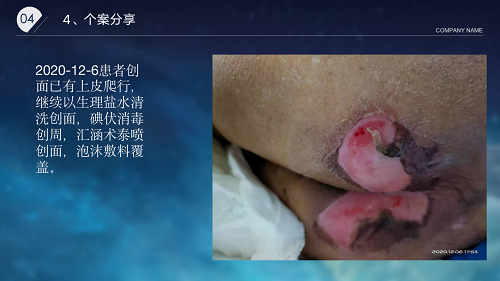 亚洲精品巨爆乳无码大乳巨