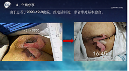 亚洲精品巨爆乳无码大乳巨
